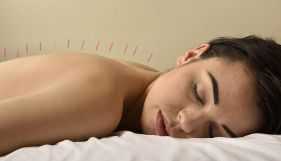 tratamiento acupuntura dejar de fumar