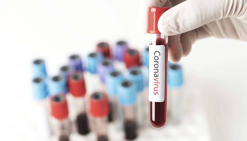 pruebas covid 19 en Lugo