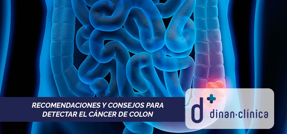 Recomendaciones y consejos para detectar el cáncer de colon